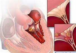 Những biến chứng nguy hiểm của sốt virus - Ảnh 2.