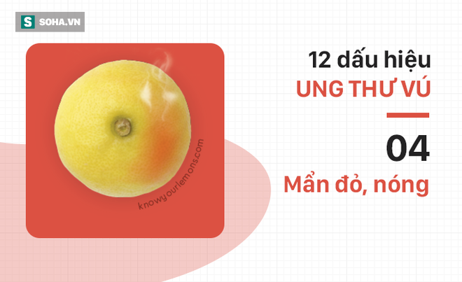 [PHOTO STORY] Giành 100% cơ hội sống quý báu khi bị ung thư nhờ hình ảnh quả chanh - Ảnh 4.