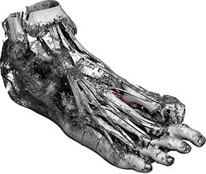 Tollund Man - Bí ẩn xác ướp 2.400 năm tuổi vẫn mỉm cười dù bị treo cổ đến chết - Ảnh 7.