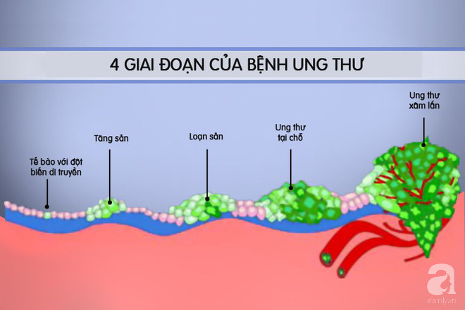 Clip cho thấy ung thư di căn phát triển như thế nào và phá hủy cơ thể người bệnh ra sao - Ảnh 2.