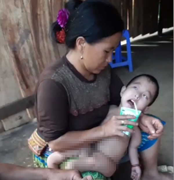 Điện Biên: Cảnh khốn cùng của gia đình dân tộc H’Mông có 3 chị em bị bệnh hiểm nghèo bị đồn do hôn nhân cận huyết - Ảnh 4.