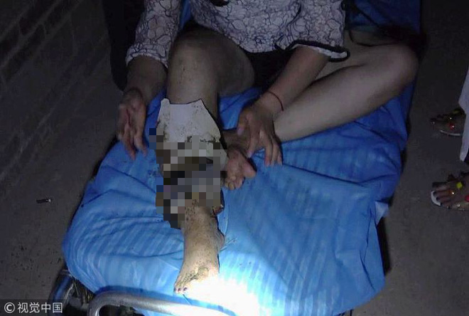 Trung Quốc: Cô gái say rượu thụt chân xuống xí xổm, lính cứu hỏa phải tới phá toa-lét mới lôi được nàng ra - Ảnh 3.