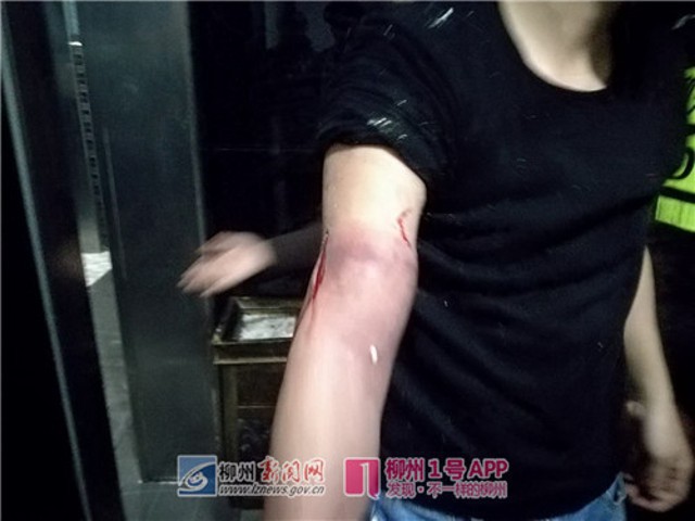 Trung Quốc: Cô gái say rượu thụt chân xuống xí xổm, lính cứu hỏa phải tới phá toa-lét mới lôi được nàng ra - Ảnh 5.