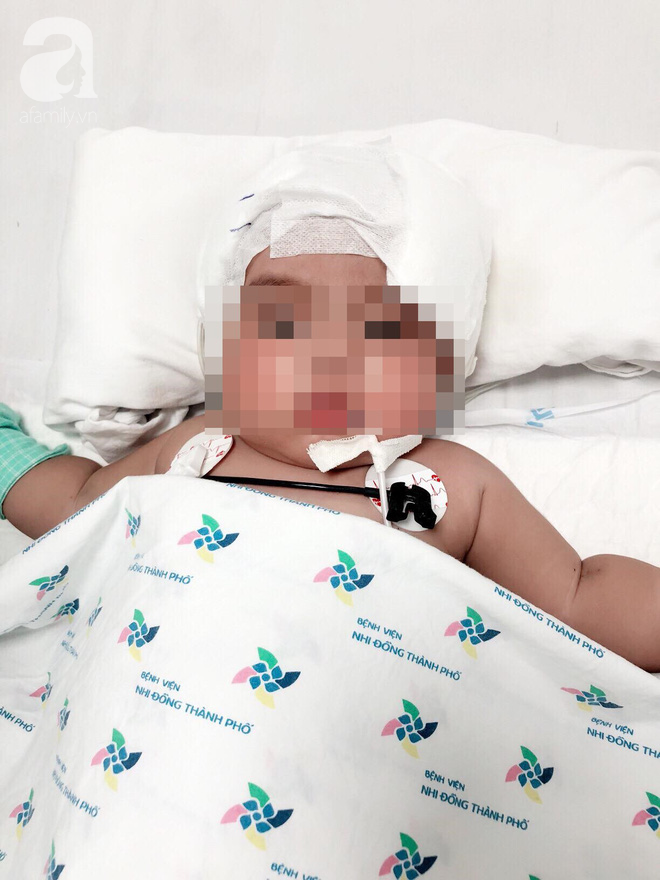 Phòng khám tư chẩn đoán nhầm viêm màng não là sốt siêu vi, bé gái 6 tháng tuổi rơi vào nguy kịch - Ảnh 1.