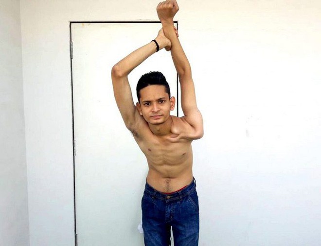 Gặp gỡ chàng trai Ấn Độ có cơ thể uốn dẻo như cao su, uốn vai 360 độ và xoay cổ 180 độ - Ảnh 4.