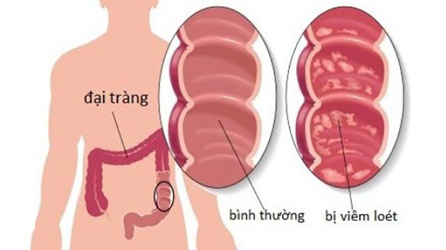 Tác dụng chữa bệnh từ mật động vật - Ảnh 1.