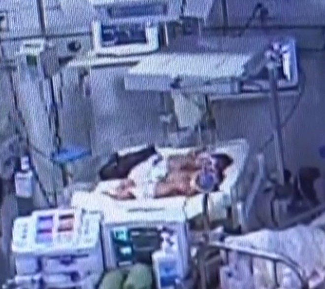 Nữ y tá quên tắt máy sấy tóc, bé sơ sinh 4 ngày tuổi bị bỏng nặng, phải cưa chân - Ảnh 2.