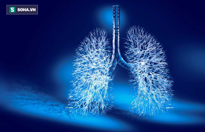 6 nhóm người có nguy cơ cao mắc ung thư phổi: 5 giải pháp phòng ngừa sớm giúp giảm tử vong - Ảnh 1.
