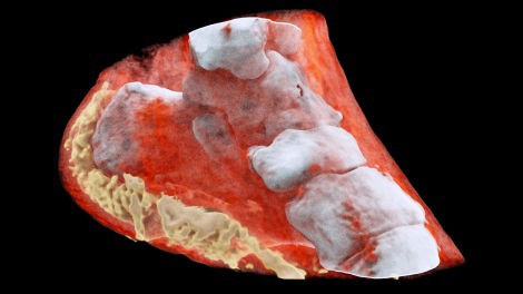 Đây là hình ảnh X-quang màu 3D đầu tiên trên thế giới, đừng xem nếu bạn yếu tim - Ảnh 3.
