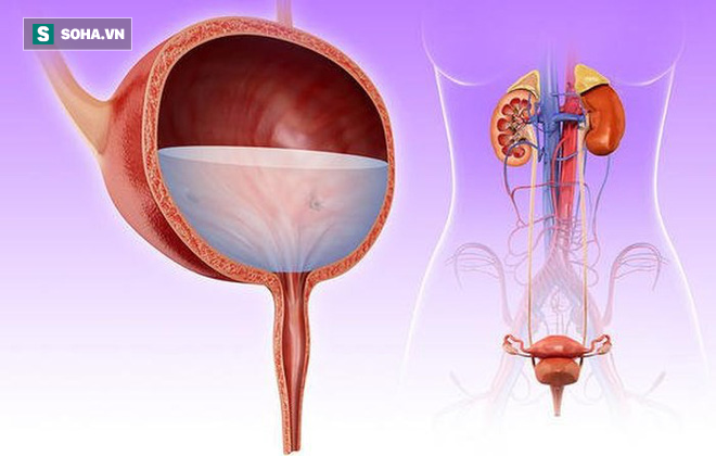 Viêm đường tiết niệu bùng phát khi trời nóng: Cách chữa hiệu quả nhất bạn nên bỏ túi sớm - Ảnh 1.