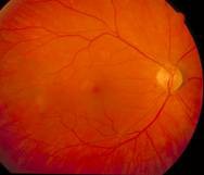 Tim mạch - Nội tiết - Máu - Những bệnh lý liên quan đến mắt không thể chủ quan - Ảnh 3.