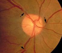 Tim mạch - Nội tiết - Máu - Những bệnh lý liên quan đến mắt không thể chủ quan - Ảnh 4.