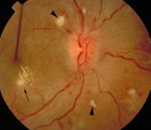 Tim mạch - Nội tiết - Máu - Những bệnh lý liên quan đến mắt không thể chủ quan - Ảnh 5.