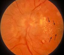 Tim mạch - Nội tiết - Máu - Những bệnh lý liên quan đến mắt không thể chủ quan - Ảnh 6.