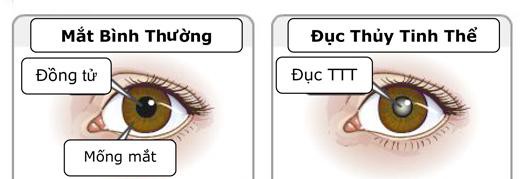Tim mạch - Nội tiết - Máu - Những bệnh lý liên quan đến mắt không thể chủ quan - Ảnh 9.