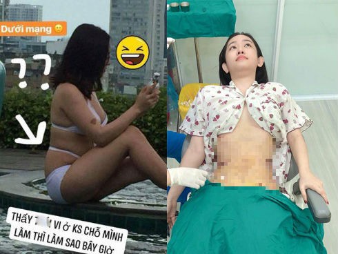 Nhan sắc hot girl Thúy Vi sau khi hút 2 kg mỡ bụng - Ảnh 3.