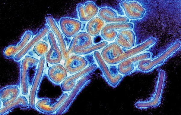 Ngày càng nhiều virus chết người lan ra khắp thế giới, và lý do thật chẳng dễ chịu chút nào - Ảnh 1.