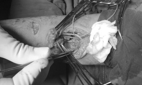 Bé gái 4 tuổi ở Sài Gòn rơi từ lầu 7 chung cư xuống thoát chết thần kì - Ảnh 3. Bé gái 4 tuổi ở Sài Gòn rơi từ lầu 7 chung cư xuống thoát chết thần kì - Ảnh 3.