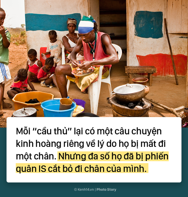 Đội bóng 1 chân tại Châu Phi chứng minh sức mạnh kinh khủng của bóng đá - Ảnh 2.