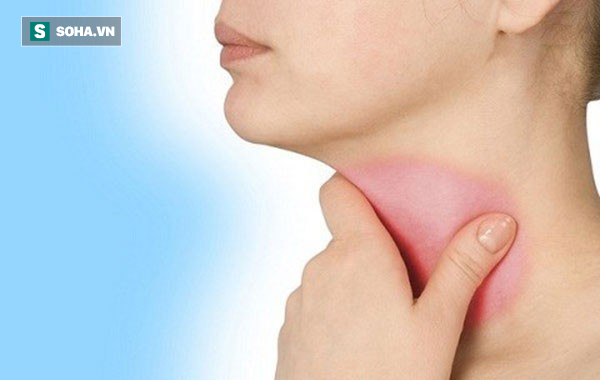 Ung thư tuyến giáp là bệnh khó phát hiện: BS khuyến cáo những người có nguy cơ cao mắc  - Ảnh 1.