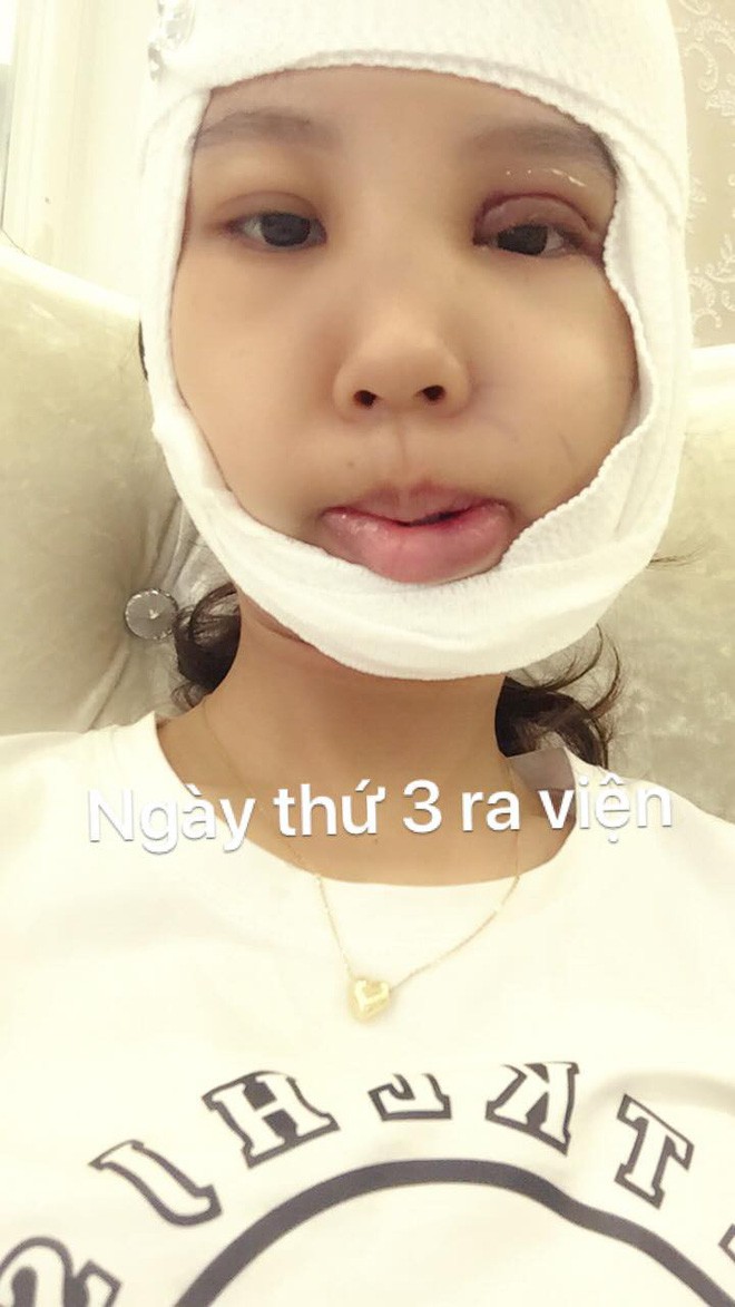 Bị bạn bè trêu chọc vì teo nửa bên mặt, cô gái Hà Nội lột xác sau phẫu thuật thẩm mỹ - Ảnh 4.