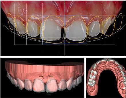 “Mê mẩn” với phương pháp bọc răng sứ tại nha khoa Kim - Ảnh 4.