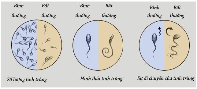 Giám đốc bệnh viện Nam học và Hiếm muộn bật mí thủ phạm khiến nam giới vô sinh - Ảnh 2.