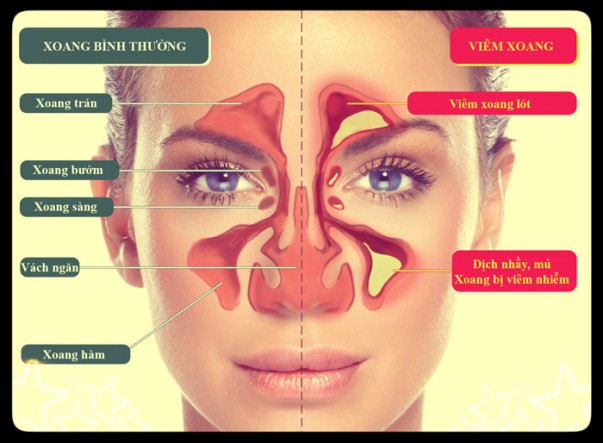 GS Đông y hướng dẫn cách chữa viêm mũi, viêm xoang hiệu quả: 5 phút/ngày, 7 ngày là khỏi - Ảnh 1.