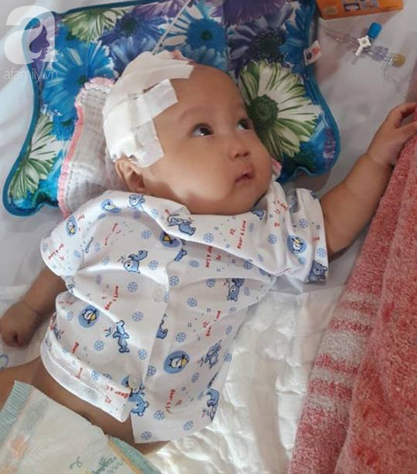 Mẹ trẻ đau đớn cầu xin mạnh thường quân cứu con trai bị não úng thủy từ lúc 2 tháng tuổi - Ảnh 2.