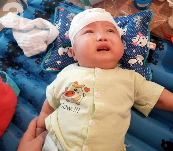 Mẹ trẻ đau đớn cầu xin mạnh thường quân cứu con trai bị não úng thủy từ lúc 2 tháng tuổi - Ảnh 3.