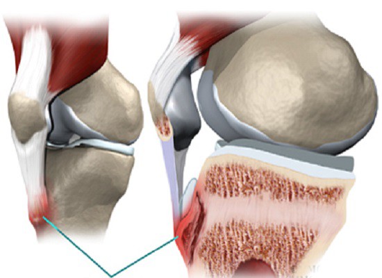 Người trẻ chớ chủ quan: BS khuyến cáo đây là loại ung thư thường gặp ở trẻ 9 – 19 tuổi - Ảnh 2.