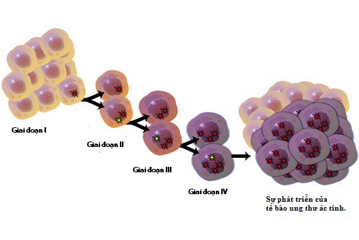 8 quan niệm sai lầm về bệnh ung thư cần từ bỏ ngay - Ảnh 1.