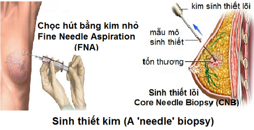 Phát hiện sớm ung thư cần làm các xét nghiệm nào? - Ảnh 1.