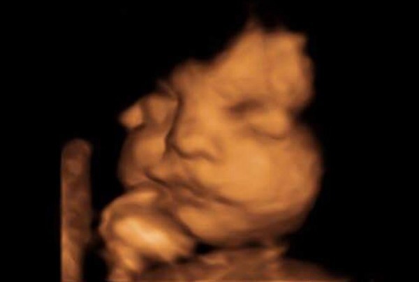 Khoảnh khắc siêu đáng yêu: Em bé quay mặt, vẫy tay chào khi còn trong bụng mẹ - Ảnh 2.