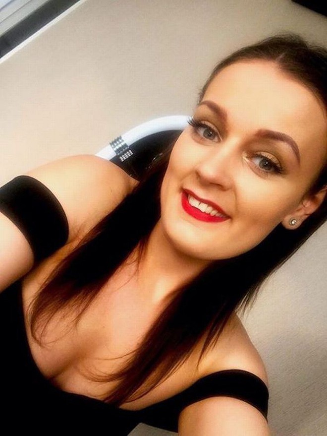 Thiếu nữ trẻ bị bỏng mắt, suy giảm thị lực vì quả trứng luộc phát nổ và lời cảnh báo tới tất cả chúng ta - Ảnh 2. Thiếu nữ trẻ bị bỏng mắt, suy giảm thị lực vì quả trứng luộc phát nổ và lời cảnh báo tới tất cả chúng ta - Ảnh 2.