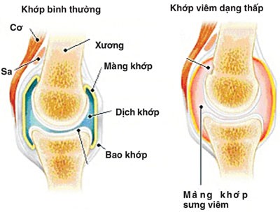 Cá basa bổ huyết, giảm đau nhức - Ảnh 2.