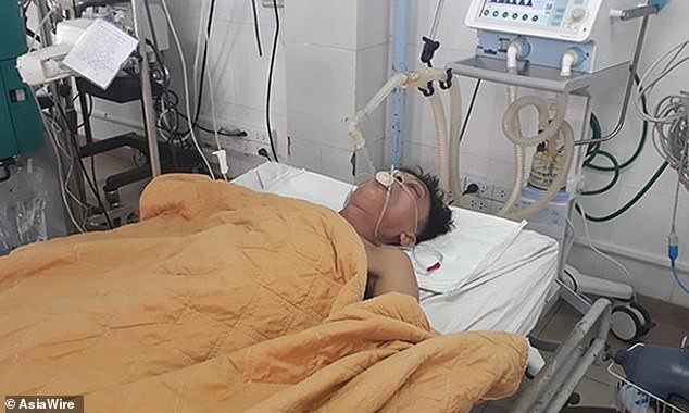 Báo nước ngoài đồng loạt đưa tin bệnh nhân Việt Nam được cứu sống nhờ bơm bia vào người - Ảnh 2.