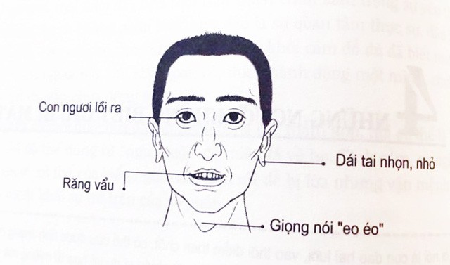 Nhận diện người đàn ông trăng hoa, lắm điều và thích ăn sẵn: Phụ nữ lấy phải, trước sau gì cũng khổ trăm bề! - Ảnh 2.