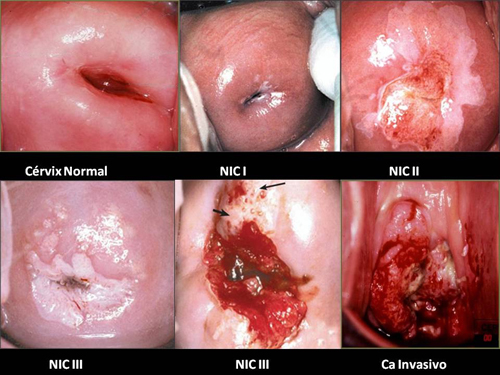 Chuyên gia ung bướu: Có những khối ung thư đẻ ra con, cháu rồi tự biến mất - Ảnh 2.