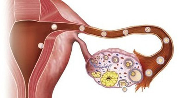 Ám ảnh 1 tuần phát hiện 3 bé mắc ung thư buồng trứng: Dấu hiệu bất thường cha mẹ cần chú ý - Ảnh 2.