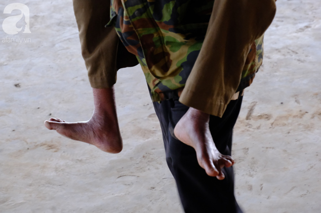 Hình ảnh xúc động tại Lào: Con trai út cõng cha già 77 tuổi bị liệt vượt hàng chục cây số đến nhờ bác sĩ Việt chữa trị - Ảnh 5. Hình ảnh xúc động tại Lào: Con trai út cõng cha già 77 tuổi bị liệt vượt hàng chục cây số đến nhờ bác sĩ Việt chữa trị - Ảnh 5.