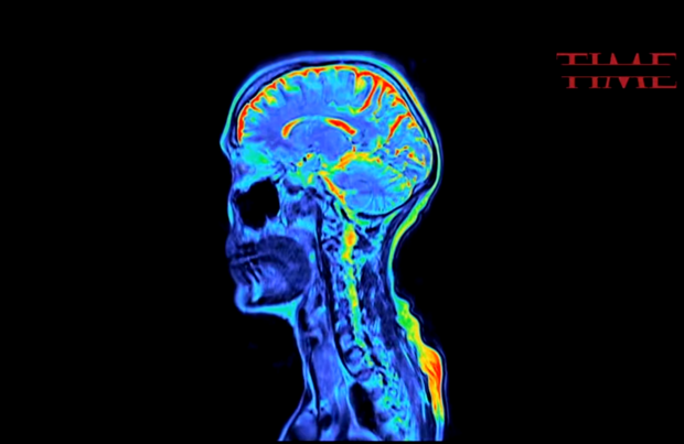 Càng hoạt động não bộ nhiều, con người càng chết sớm, ít dùng não lại sống lâu - Ảnh 2.
