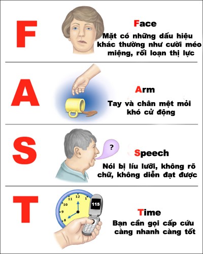 Cảnh giác với căn bệnh gây tử vong đứng hàng thứ 3 chỉ sau ung thư và tim mạch - Ảnh 2.