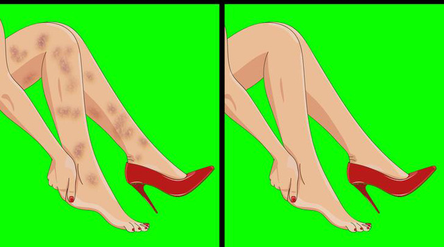 Xuất hiện 6 dấu hiệu này ở chân, bạn nên sớm đi gặp bác sĩ bởi sức khỏe đang gặp vấn đề nghiêm trọng - Ảnh 3.