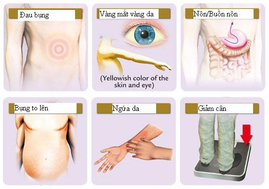 Căn bệnh ung thư có tỷ lệ mắc cao số 1 tại Việt Nam: 7 nhóm người có nguy cơ mắc cao - Ảnh 1.
