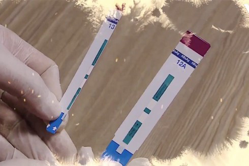 Cắt đôi que xét nghiệm HIV, bớt xén vật tư nguy hiểm thế nào? - Ảnh 1.