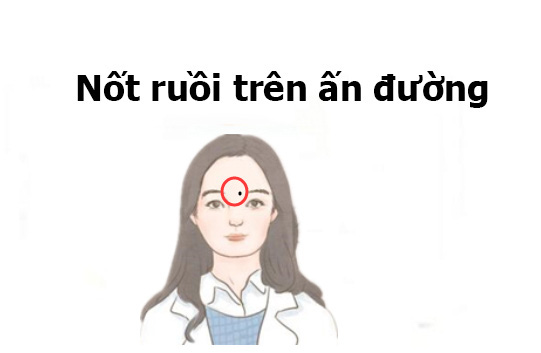 Phụ nữ sở hữu nốt ruồi ở những vị trí này, trời sinh mang mệnh Thiên Kim, cả đời giàu có phú quý, đi đến đâu thịnh vượng đến đó - Ảnh 1.