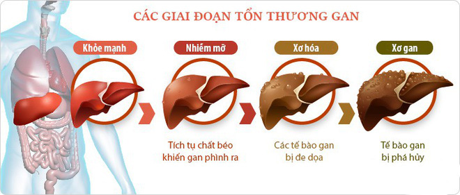 Những lá gan được in 3D sinh học sẽ tạo ra cuộc cách mạng trong lĩnh vực cấy ghép nội tạng - Ảnh 3.