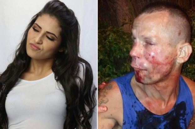 Cướp nhầm nữ đô vật UFC xinh đẹp, tên trộm đen đủi bị đánh cho bầm dập mặt mũi phải cầu cứu cảnh sát - Ảnh 1.