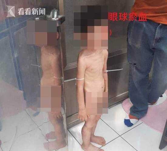 Phẫn nộ cậu bé 3 tuổi bị bố và người tình bạo hành mỗi ngày, đói tới mức phải lấy phân để ăn - Ảnh 1.